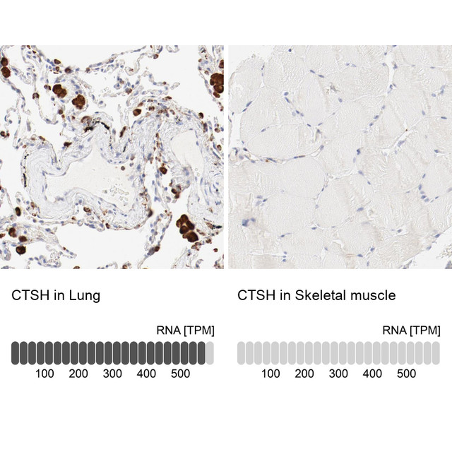Immunohistochemistry analysis in human lung and skeletal muscle tissues using Anti-CTSH antibody. Corresponding CTSH RNA-seq data are presented for the same tissues.
